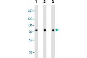 Western blot analysis of Lane 1: A549 cell line lysates Lane 2: A431 cell line lysates Lane 3: SK-BR-3 cell line lysates reacted with CAPN2 monoclonal antibody  at 1:1000 dilution.