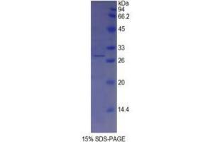 SDS-PAGE analysis of Pig Tyrosinase Protein.