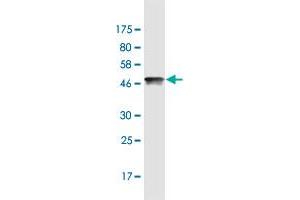 Western Blot detection against Immunogen (47. (HMGB2 Antikörper  (AA 1-195))