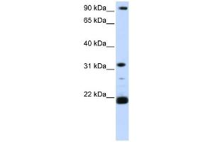 WB Suggested Anti-SNF8 Antibody Titration: 0. (SNF8 Antikörper  (C-Term))