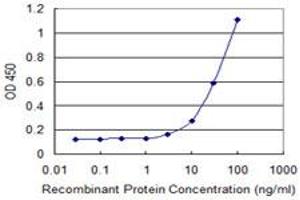 Detection limit for recombinant GST tagged PML is 1 ng/ml as a capture antibody. (PML Antikörper  (AA 411-510))