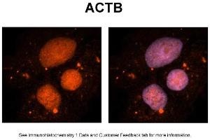 Sample Type: NT2 cells Red: Antibody Blue: DAPI Primary Dilution: 1ug/50ul antibody Secondary Antibody: Alexa goat anti-rabbit 594 Image Submitted by: Yuzhi Chen, University of Arkansas for Medical Sciences (beta Actin Antikörper  (Middle Region))