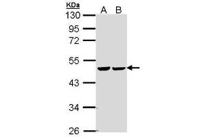 WB Image Sample (30 ug of whole cell lysate) A: 293T B: A431 , 10% SDS PAGE antibody diluted at 1:5000 (FH Antikörper)