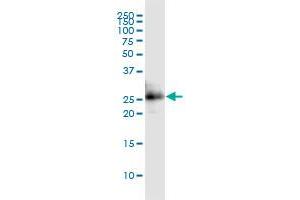 Western Blotting (WB) image for anti-Cbp/p300-Interacting Transactivator, with Glu/Asp-Rich Carboxy-terminal Domain, 1 (CITED1) (AA 94-193) antibody (ABIN518015)