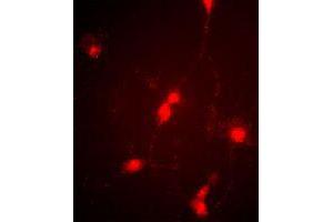 Immunofluorescence image of cultured chick retinal amacrine (neuronal) cells labeled with CLCN4 polyclonal antibody . (CLCN4 Antikörper  (C-Term))