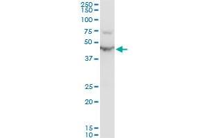 ENO1 polyclonal antibody (A01), Lot # SFU4050831QCS1. (ENO1 Antikörper  (AA 1-434))