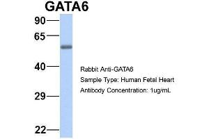 Host:  Rabbit  Target Name:  GATA6  Sample Type:  Human Fetal Heart  Antibody Dilution:  1.