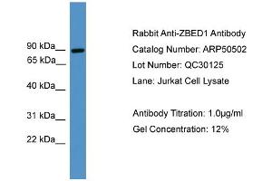 WB Suggested Anti-ZBED1  Antibody Titration: 0.