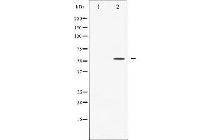 Western Blotting (WB) image for anti-Caspase 8 (CASP8) (pSer347) antibody (ABIN6256281)