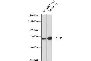 Western blot analysis of extracts of various cell lines, using CLN5 antibody (ABIN6133293, ABIN6138735, ABIN6138736 and ABIN6216682) at 1:3000 dilution.