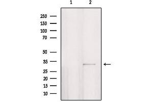 Western blot analysis of extracts from HepG2, using PPP1R3D Antibody. (PPP1R3D Antikörper  (Internal Region))
