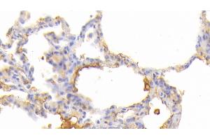 Detection of JAK3 in Human Lung Tissue using Polyclonal Antibody to Janus Kinase 3 (JAK3) (JAK3 Antikörper  (AA 716-967))