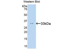 Western Blotting (WB) image for anti-Signal Transducer and Activator of Transcription 6, Interleukin-4 Induced (STAT6) (AA 262-520) antibody (ABIN1860655) (STAT6 Antikörper  (AA 262-520))