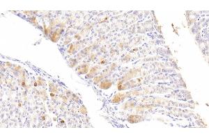 Detection of DGKz in Mouse Stomach Tissue using Polyclonal Antibody to Diacylglycerol Kinase Zeta (DGKz) (DGKZ Antikörper  (AA 657-879))