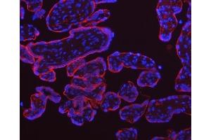 IF analysis of TFRC using anti-TFRC antibody (ABIN3043538). (Transferrin Receptor Antikörper  (AA 1-198))
