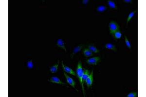 Immunofluorescent analysis of Hela cells using ABIN7149094 at dilution of 1:100 and Alexa Fluor 488-congugated AffiniPure Goat Anti-Rabbit IgG(H+L) (CYBB Antikörper  (AA 283-570))
