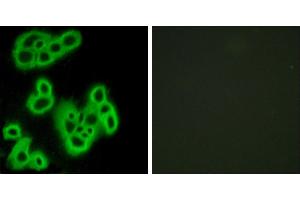 Peptide - +Western blot analysis of extracts from K562 cells, using FPR1 antibody. (FPR1 Antikörper  (Internal Region))