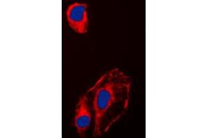 Immunofluorescent analysis of HSP90 beta (pS254) staining in HeLa cells. (HSP90AB1 Antikörper  (pSer254))