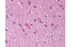 Anti-GABRQ antibody IHC of human brain, cortex. (GABRQ Antikörper  (AA 31-80))
