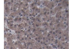 DAB staining on IHC-P; Samples: Porcine Liver Tissue (CRP Antikörper  (AA 20-222))