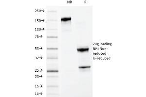 SDS-PAGE Analysis Purified MYDAM Monoclonal Antibody (MYADM/972). (MYADM Antikörper)