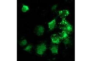 Anti-ANKRD53 mouse monoclonal antibody (ABIN2454288) immunofluorescent staining of COS7 cells transiently transfected by pCMV6-ENTRY ANKRD53 (RC206701). (ANKRD53 Antikörper  (AA 1-300))