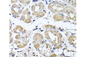Immunohistochemistry of paraffin-embedded Human stomach using IFNL1 Polyclonal Antibody at dilution of 1:100 (40x lens). (IL29 Antikörper)