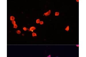 Immunofluorescence analysis of SH-SY5Y cells using CDK5R1 Polyclonal Antibody at dilution of 1:100. (CDK5R1 Antikörper)