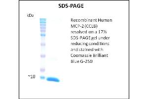 SDS-PAGE (SDS) image for Chemokine (C-C Motif) Ligand 8 (CCL8) (Active) protein (ABIN5509367)