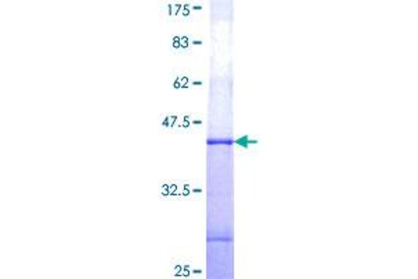 GUCY2F Protein (AA 311-420) (GST tag)