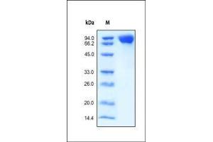 Human M-CSF R, His Tag on SDS-PAGE under reducing (R) condition. (CSF1R Protein (AA 20-512) (His tag))