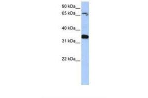 Image no. 1 for anti-GLE1 RNA Export Mediator (GLE1) (AA 218-267) antibody (ABIN6738958)