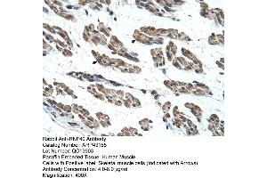 Human Muscle (RNF40 Antikörper  (C-Term))