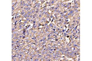 IHC analysis of Drebrin/DBN1 using anti-Drebrin/DBN1 antibody (ABIN7602638).