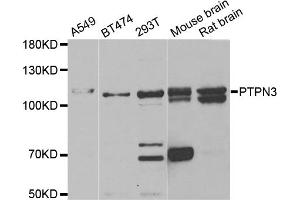Western blot analysis of extracts of various cell lines, using PTPN3 antibody. (PTPN3 Antikörper)