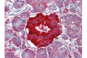 Immunohistochemistry (Paraffin-embedded Sections) (IHC (p)) image for anti-Transthyretin (TTR) antibody (ABIN615282)