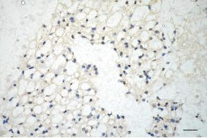 anti-Integrin beta 1 Binding Protein 1 (ITGB1BP1) antibody