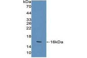 Detection of Recombinant KLRK1, Human using Polyclonal Antibody to Killer Cell Lectin Like Receptor Subfamily K, Member 1 (KLRK1)