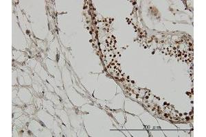 Image no. 7 for anti-Tripartite Motif Containing 33 (TRIM33) (AA 1006-1106) antibody (ABIN599250) (TRIM33 Antikörper  (AA 1006-1106))