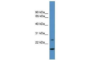 TFPI2 antibody used at 0. (TFPI2 Antikörper  (N-Term))