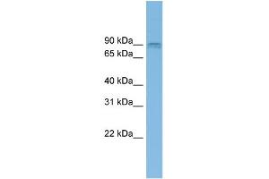 WB Suggested Anti-CENTG1 Antibody Titration: 0. (AGAP2 Antikörper  (Middle Region))
