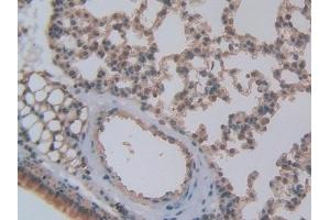 Immunohistochemistry (IHC) image for anti-Pro-Platelet Basic Protein (Chemokine (C-X-C Motif) Ligand 7) (PPBP) (AA 40-113) antibody (ABIN7431662)