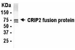 Western Blotting (WB) image for anti-Cysteine-Rich Protein 2 (CRIP2) (AA 1-208) antibody (ABIN2467798) (CRIP2 Antikörper  (AA 1-208))
