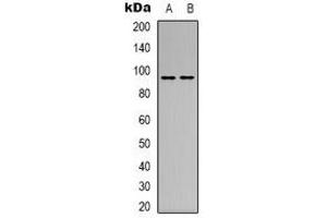 Western blot analysis of CD100 expression in MCF7 (A), L929 (B) whole cell lysates. (SEMA4D/CD100 Antikörper  (N-Term))
