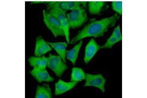 Immunofluorescence (IF) image for anti-Hexokinase 1 (HK1) (AA 1-917), (N-Term) antibody (ABIN317095)