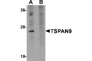 Western Blotting (WB) image for anti-Tetraspanin 9 (TSPAN9) (Middle Region) antibody (ABIN1031151)