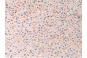 IHC-P analysis of Rat Liver Tissue, with DAB staining. (SERPINA10 Antikörper  (AA 278-425))