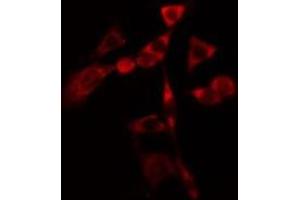 ABIN6275806 staining  Hela cells by IF/ICC. (CYP1B1 Antikörper  (Internal Region))