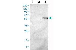 Western Blot analysis of Lane 1: RT-4 cell, Lane 2: U-251 MG sp cell and Lane 3: human plasma tissue (IgG/HSA depleted) lysates with ZMPSTE24 polyclonal antibody . (ZMPSTE24 Antikörper)