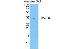 Western blot analysis of the recombinant protein. (AZGP1 Antikörper  (AA 18-296))